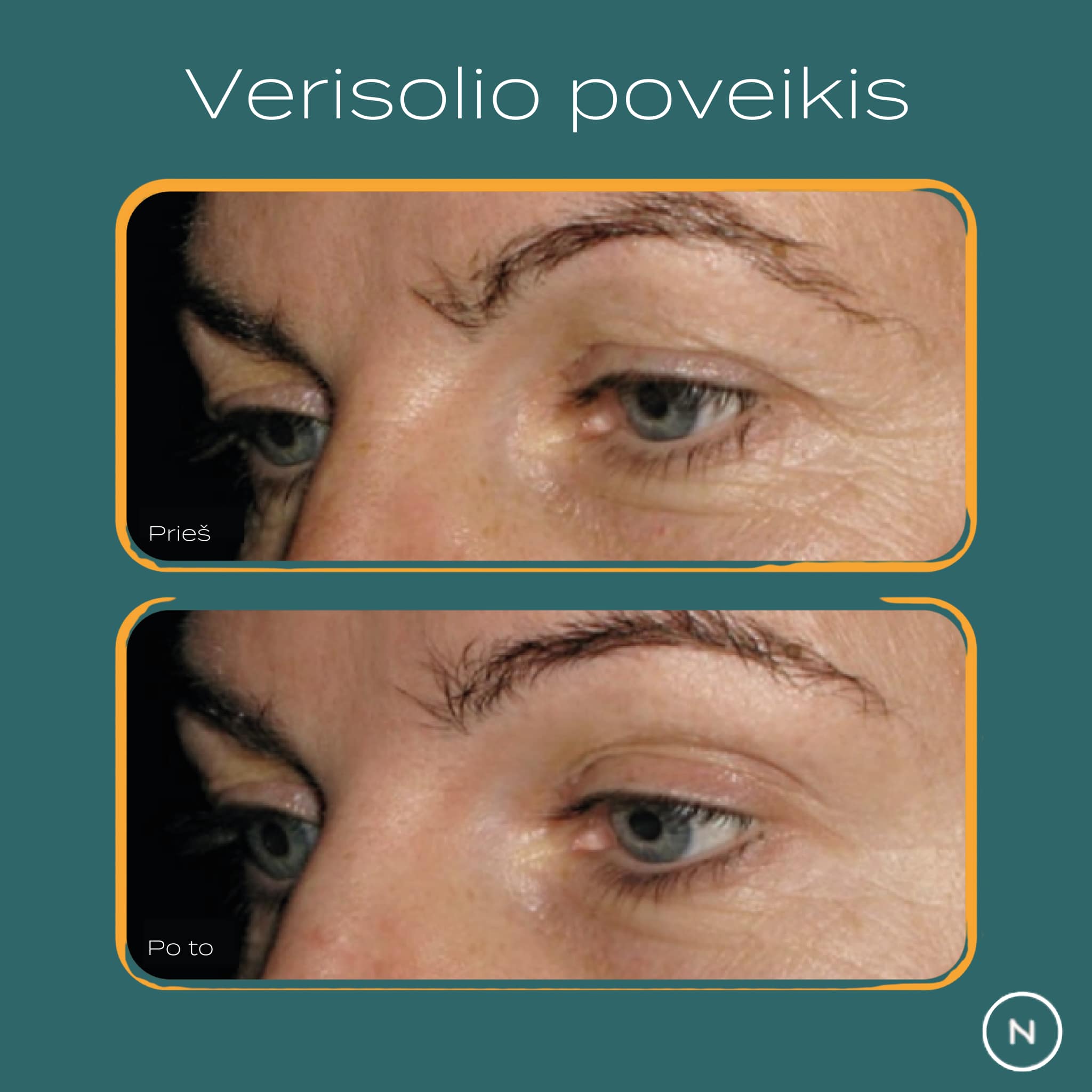 hidrolizuotas kolagenas kas tai