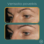 hidrolizuotas kolagenas kas tai